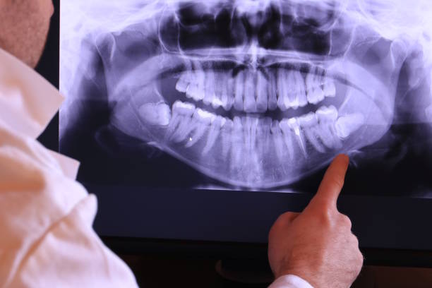 Best Emergency Root Canal Treatment in Montgomery, MN