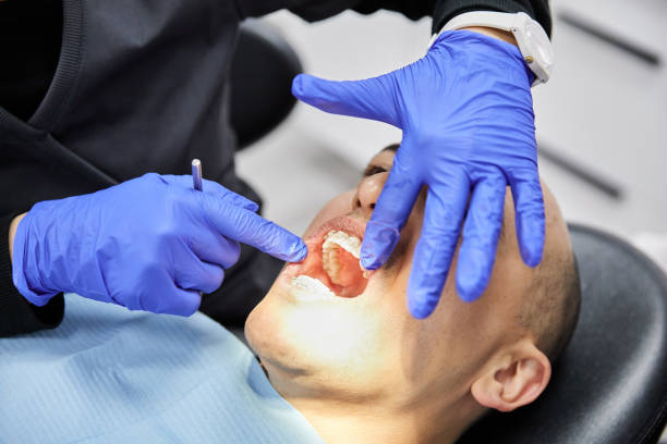 Best Emergency Tooth Extraction in Montgomery, MN
