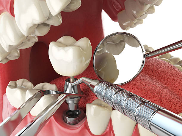 Best Emergency TMJ Treatment in Montgomery, MN